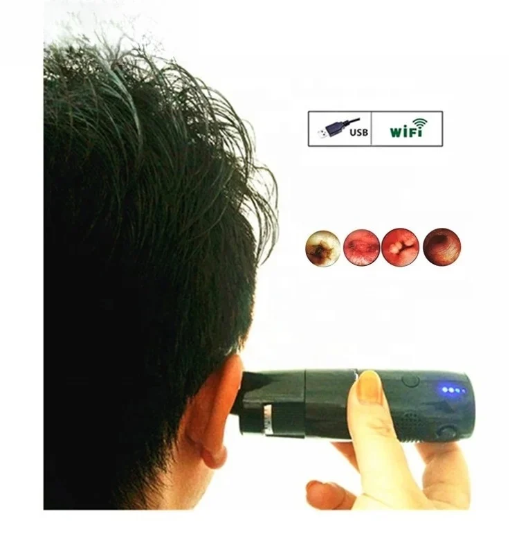 

Digital Wifi Microscope Support IOS/Android/WIndows with HD Video Household Wifi Otoscope Wireless Endoscope