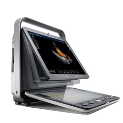 Products subject to negotiationPortable ultrasonido sonoscape Color Doppler 4D Ultrasound Machine Sonoscape S9 Medical