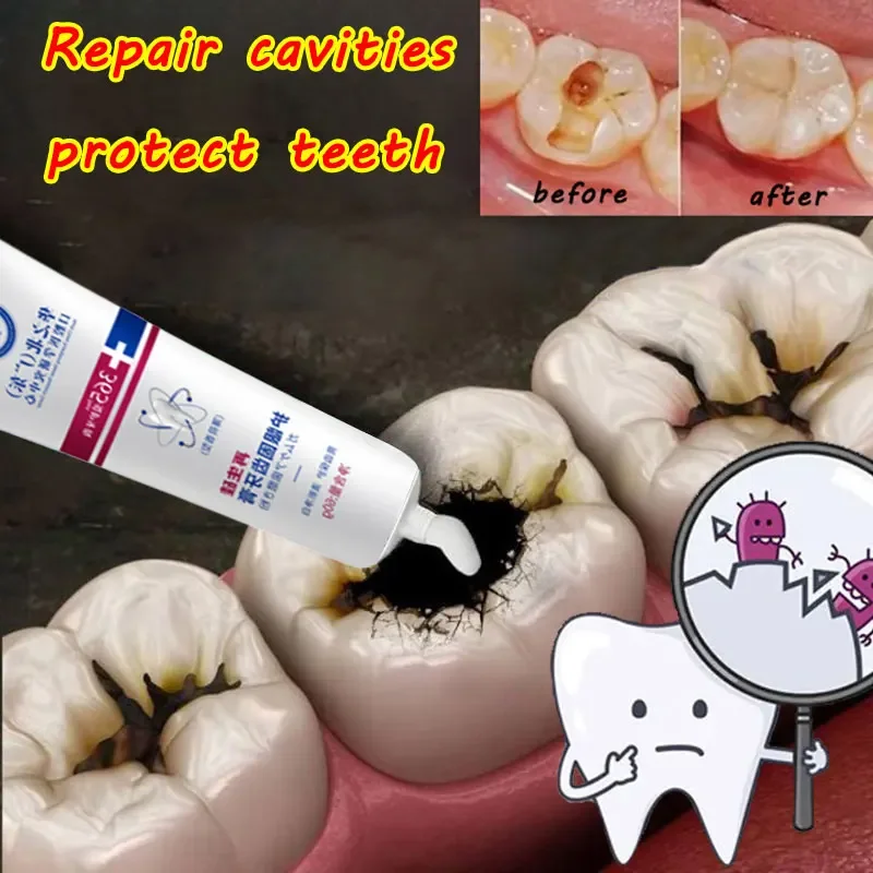 

New Sdottor Toothpaste Quickly Repair Gums Decay Cavities Caries Protect Teeth Whitening Toothpaste To Remove Plaque Eliminate B