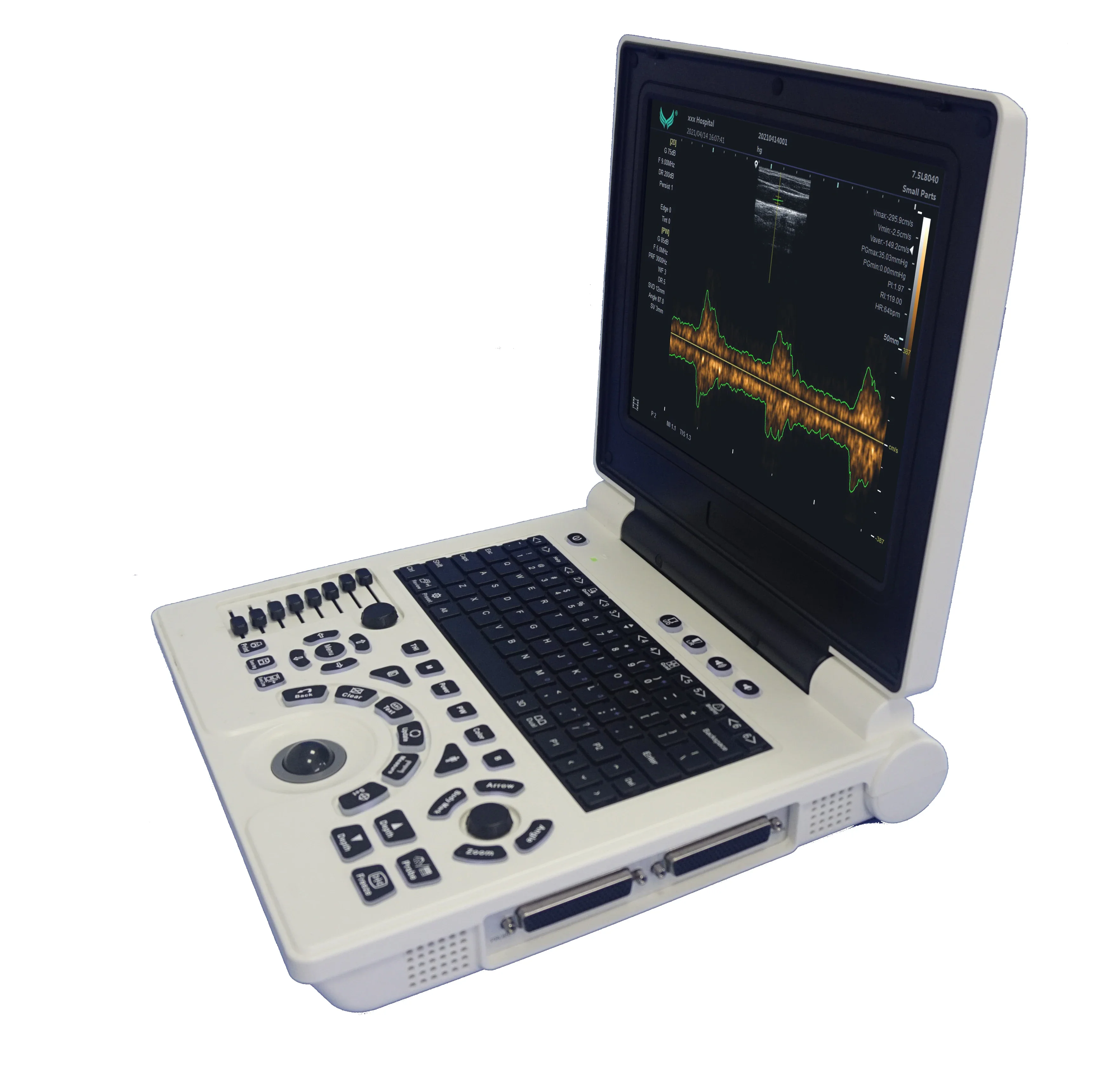 Factory Manufacture Various P20 Notebook Ultrasonic Diagnostic System Machine China Premium Ultrasound