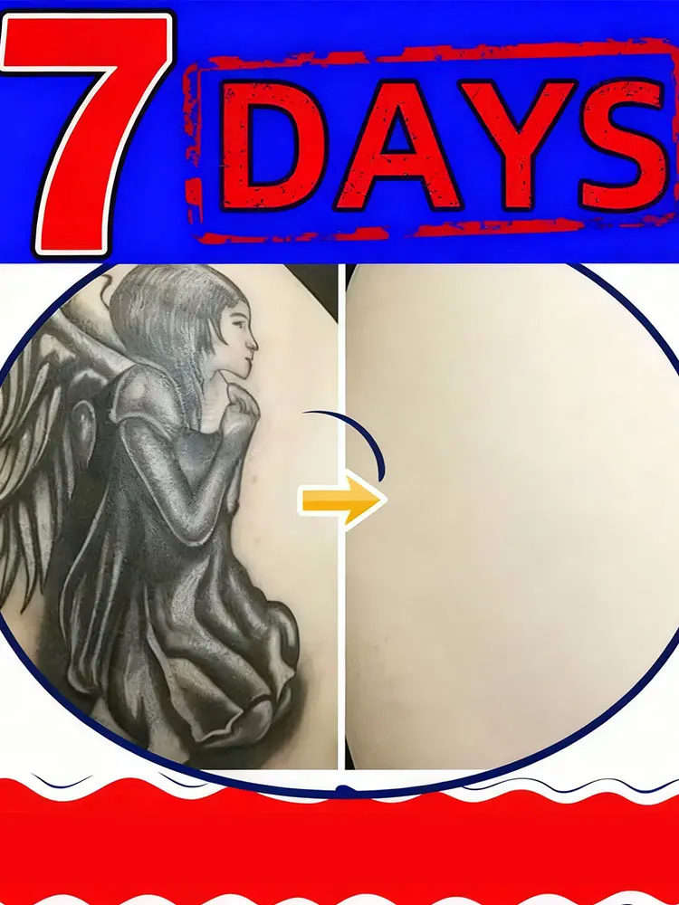 Fade stubborn tattoos effective in removing permanent tattoos