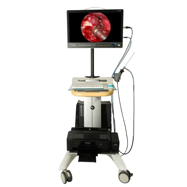 

22 inch LCD Monitor Medical Portable Endoscope ENT Video Camera for Bronchoscope/Nasopharyngoscope / Cystoscope /Ureteroscope