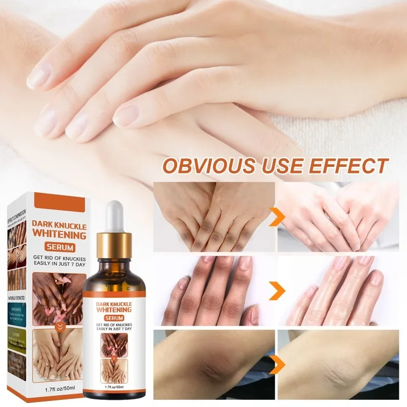 Donkere Knokkels Snel Helderen Serum Vrouwen Hand Knokkel Verlichting Melanine Essentie Ellebogen Knie Vervagen Product Verheldering Zorg