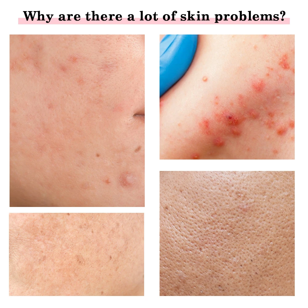 4-in-1-Schönheitsgerät, rote und blaue Lichttherapie, Hautverjüngung, Hautstraffung, Augenpflege, Gesichtsreinigung, Facelift, Gesichtsmassagegerät