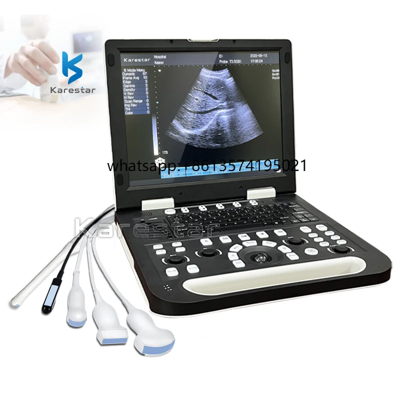 

Portable Ultrasound Machine Veterinary Instrument Ultrasound Machine for Animal/cattle Cow Horse Goat Use