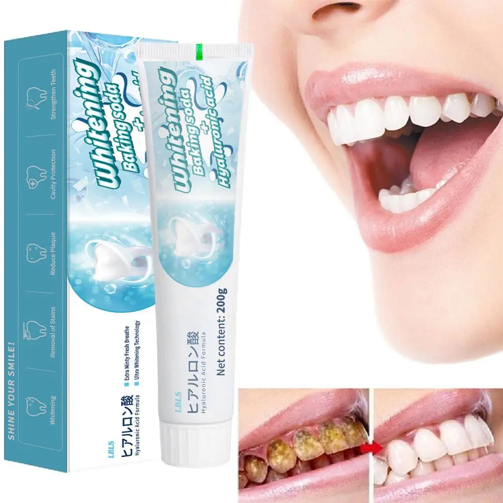 Creme dental para clarear, 200g, para dentes, remoção de manchas, cuidados orais, refrigerante, n4e9