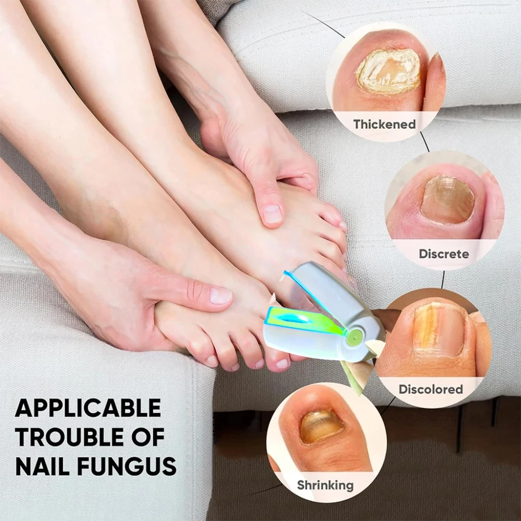 

Nail Fungus Laser Treatment Device Fast Repair Toenail Fingernail Care Kit for Onychomycosis Cleaning Relief Tool