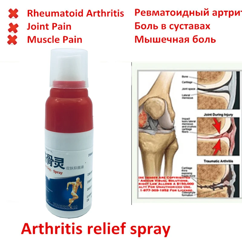 

Bones Ling Pain Relief Spray Muscle Sprain Knee Waist Pain Rheumatism Arthritis Back Shoulder Spray Tiger Orthopedic Plaster