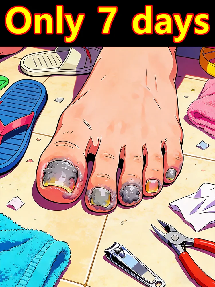 

Hᴏᴛ Sᴀʟᴇ 2026 Nᴀɪʟ Rᴇᴘᴀɪʀ Oɪʟ - Pʀᴏғᴇssɪᴏɴᴀʟ Dᴀᴍᴀɢᴇᴅ Nᴀɪʟ Rᴇsᴛᴏʀᴀᴛɪᴏɴ Mᴀɴɪᴄᴜʀᴇ