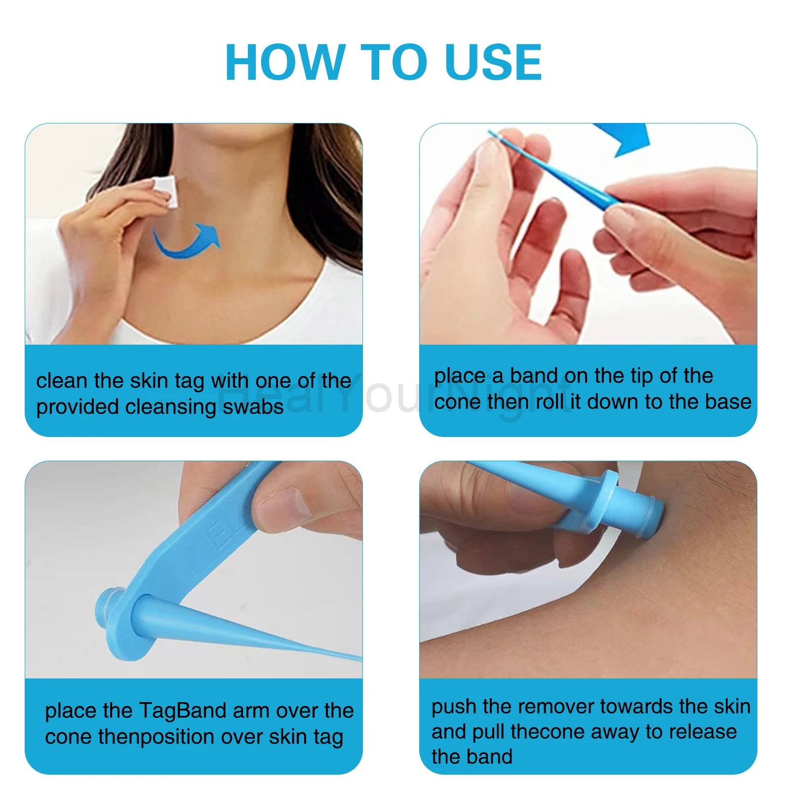 3-IN-1 مجموعة إزالة علامات الجلد التلقائي غير مؤلم الجلد التسمية الخلد حب الشباب الثآليل إزالة مجموعة أقلام مع مسحات التطهير أداة العناية بالجمال الوجه
