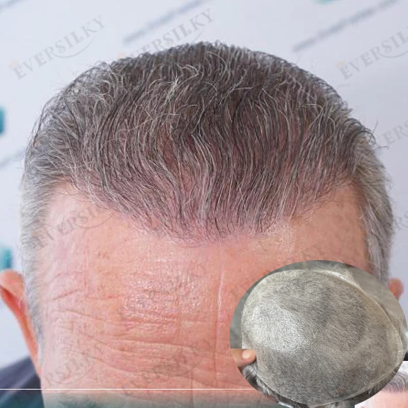 Mikrodünne Hautbasis-Männerperücken, unsichtbar, 0,02 mm, super natürlicher Haaransatz, Herren-Toupet, 100 % Echthaar, Kapillarprothesensystem – Detail 1