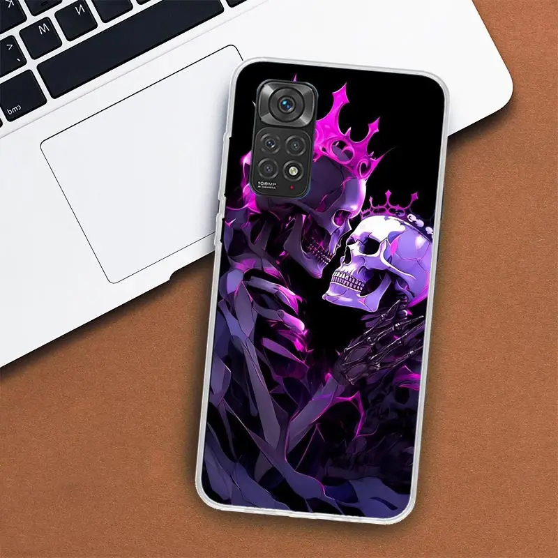 Anatomy Skeleton Heart Lovey Kiss Phone Case For Xiaomi Redmi Note 13 12 12S 11 11S 10 10S 9 9S 11T 11E Pro Plus 8 8T 7 + Coque