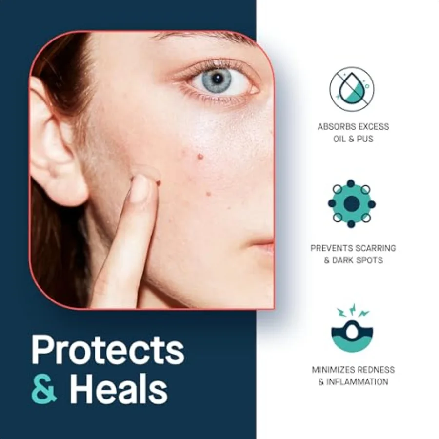 SLMD de Dr. Pimple Popper Parches para espinillas de ácido salicílico Tratan el acné y la impara la apariencia de las manchas oscuras Parche transparente fino