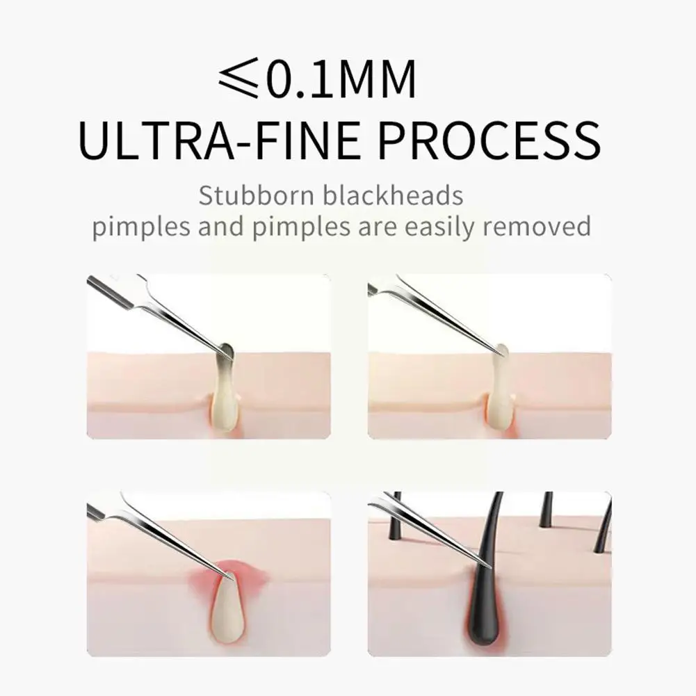 Alemão Ultra-Fine Blackhead Removedor, No.5 Celular Espinhas Clip, 0.1mm, Poros Pontos Agulha, Removedor de Acne, Pinças Limpador, Blac G3W6