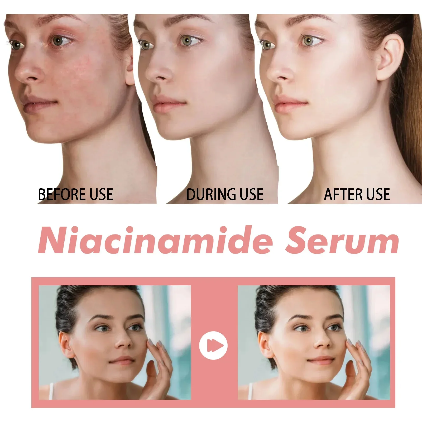 พีช 70% Niacinamide Serum 30ml ป้องกันความแห้งกร้านน้ํามันหอมระเหยบนใบหน้าเพิ่มความยืดหยุ่นเรียบเนียนนุ่ม Skin Care