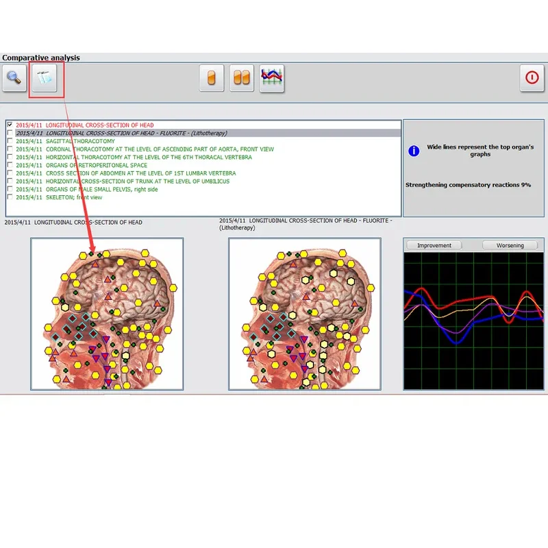 

2026 Hunter 4025 NLS Meta-Pathology Meta-Therapy Dragon Non-Linear Standard System Health Analyser Scanner Acupuncture Body Scan