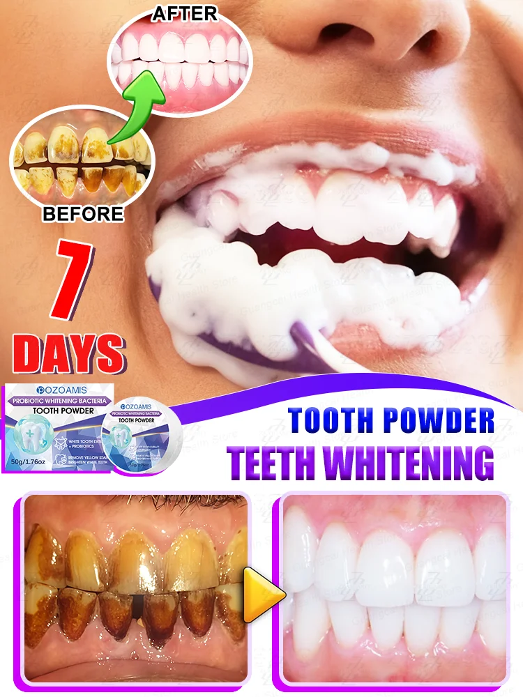 Probiotic ᴡʜɪᴛᴇɴɪɴɢ ᴛᴏᴏᴛʜ powder: Rᴇᴍᴏᴠᴇs ᴛᴀʀᴛᴀʀ and eliminates bad ʙʀᴇᴀᴛʜ