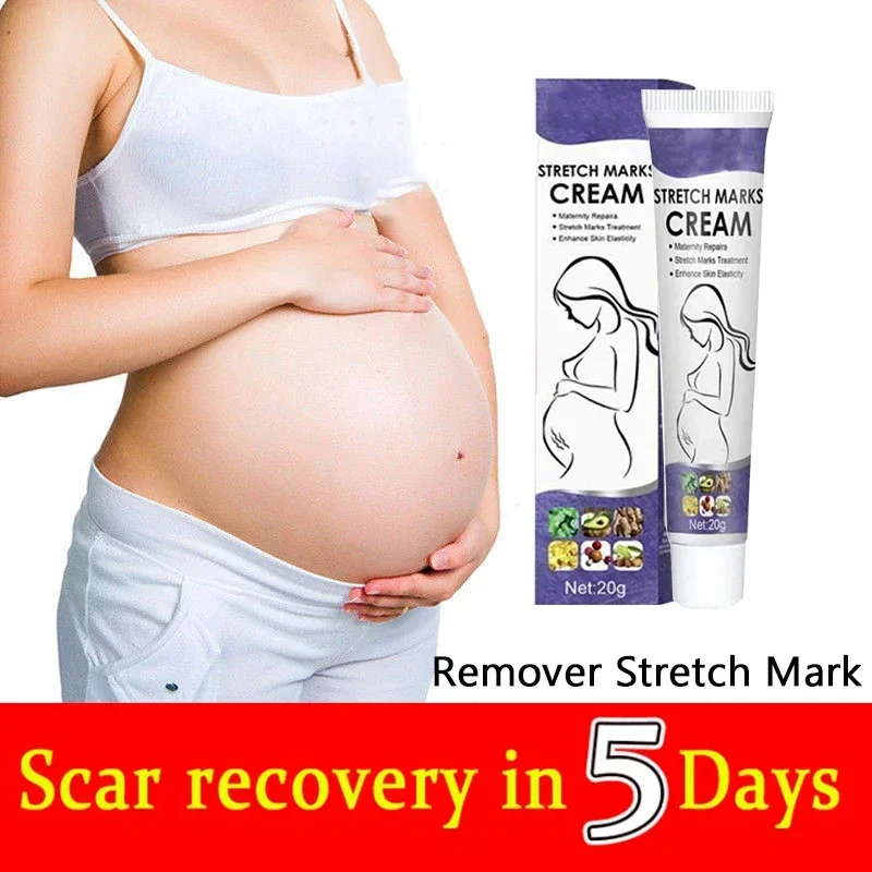 Permanent Removal Cream Eliminate Body Belly Stretch Marks For Tunnels  Effective Stretch Marks  Scar Removal Serum 3