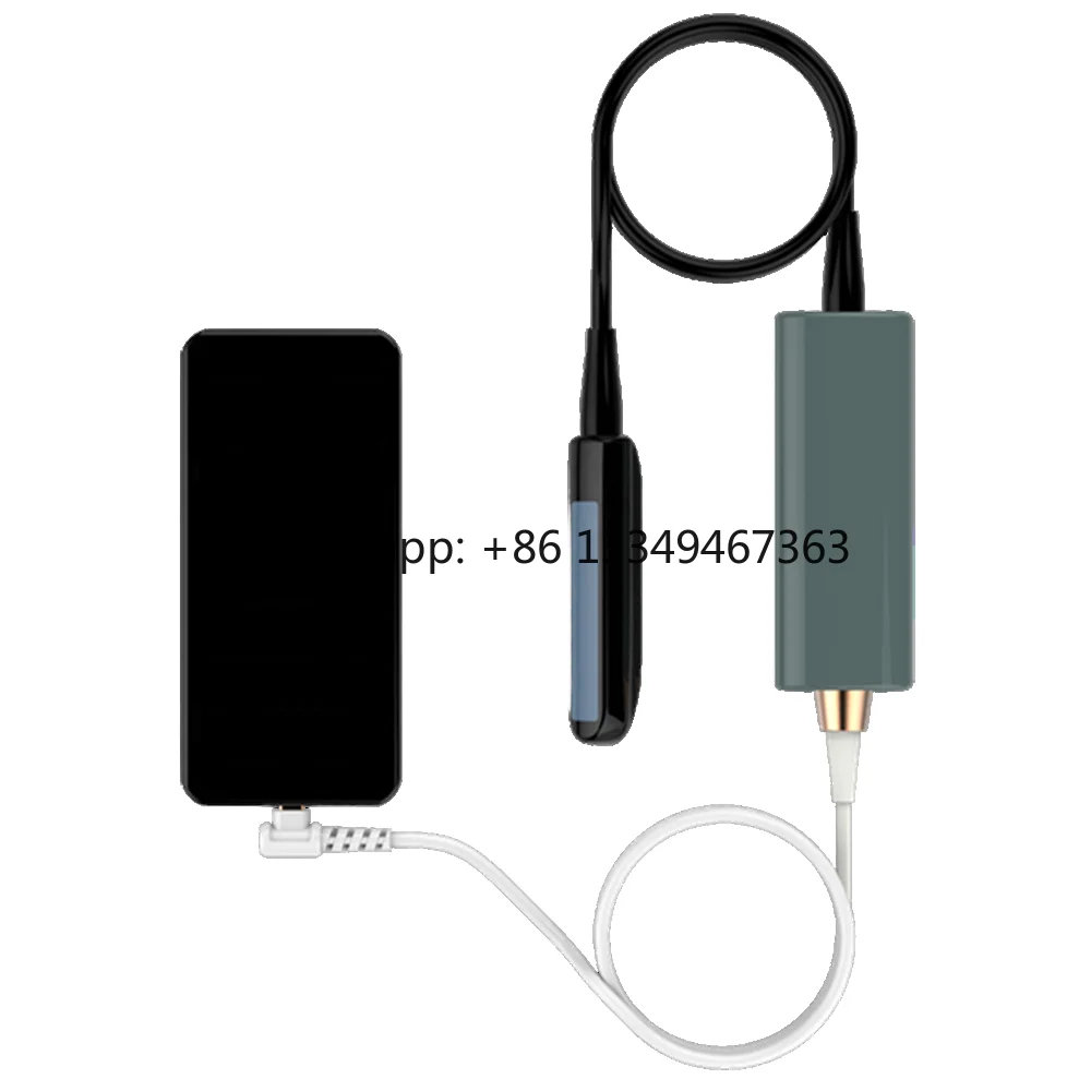 UL8-4T USB Portable Veterinary  for Cattle Vet Rectal
