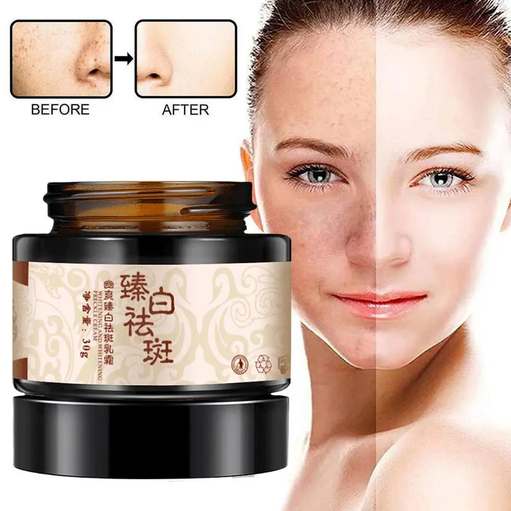 30g Powerful Whitening Freckle Cream Plant Face Cream Cream Freckle N1S2 Freckles Dark Face Remove Plant Whiteni Spots Crea D2G5