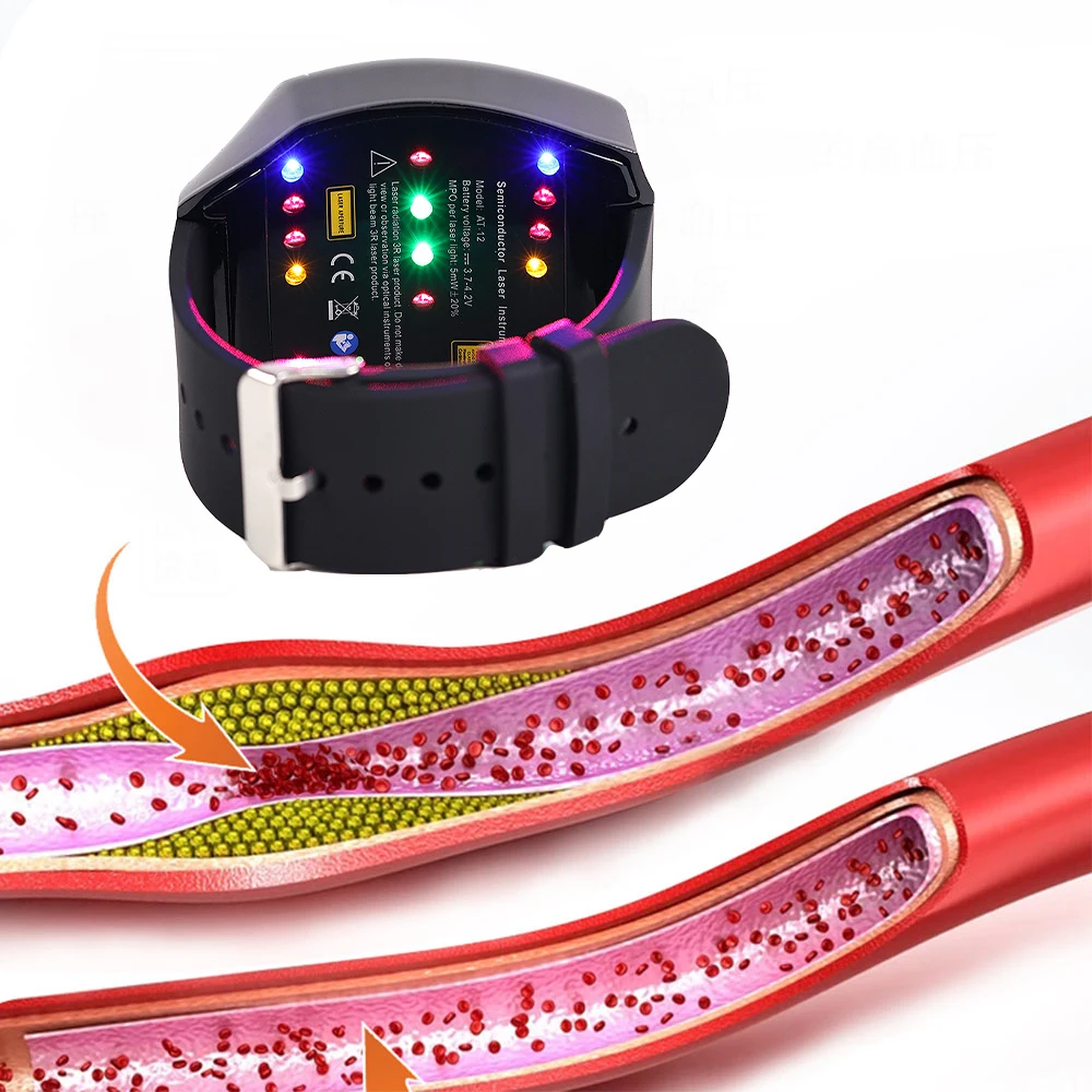 Laser Therapy Watch with four colors Multiple colors correspond to different functions Treating Hypertension in Diabetes