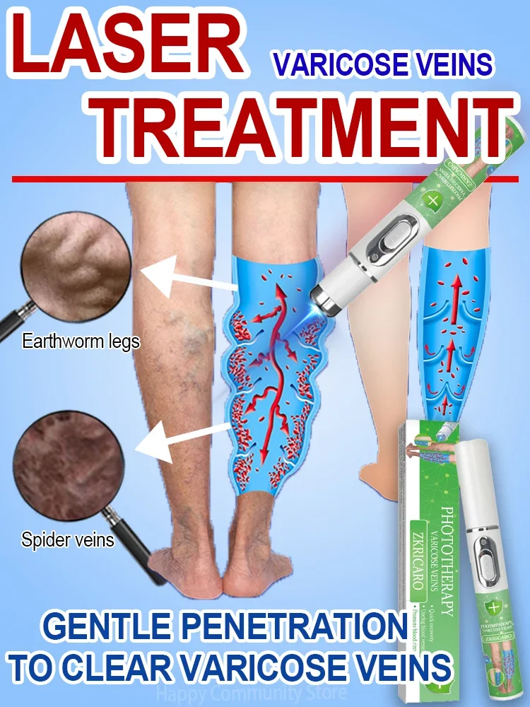 

Hot sale Nano Laser Leg Vein