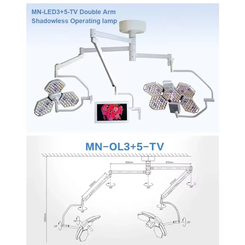 수술 환자 무영등 수술실 조명 스크린 수술용 의료 수술 조명 천장 장착