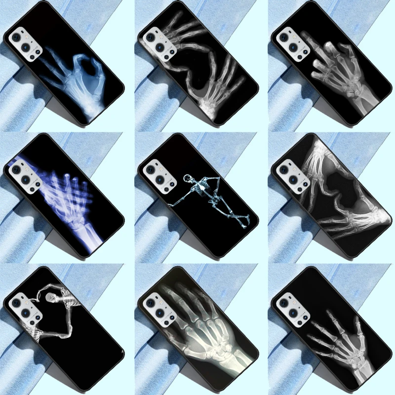 X-ray Hand Bones Phone Case For Oneplus Nord 2 T Ace 10R 9 R One Plus 10 9 Pro Soft Silicone Back Cover Funda