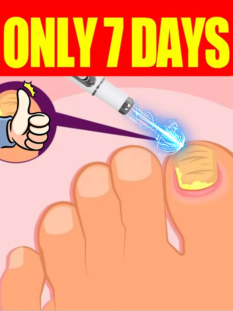 

2nd generation of champagne-colored nail blue light pen Powerful repair, reshape healthy nails,prevent recurrence