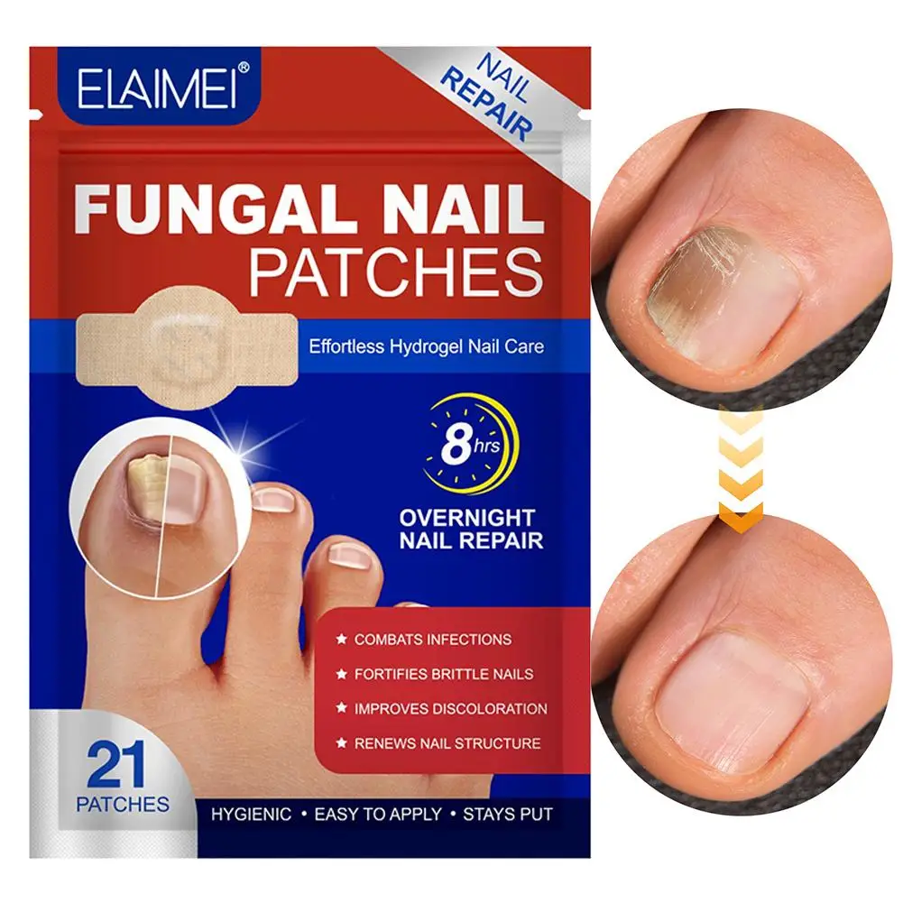 21 Teile/satz Fuß Nagel Reparatur Patch Grau Pilz Nagel Verdicken Weiche Paronychie Infektion Hand Nagel Korrektur Aufkleber Eingewachsene Zehennagel