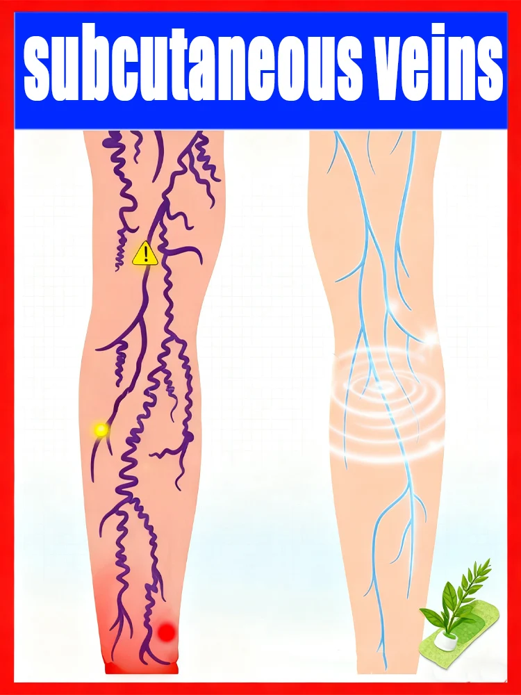 

Veias subcutâneas recuperam a saúde