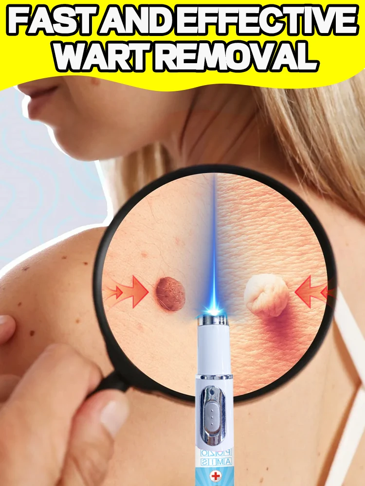 

Precise targeting of stubborn ʷᵃʳᵗˢ, reaching the root cause.