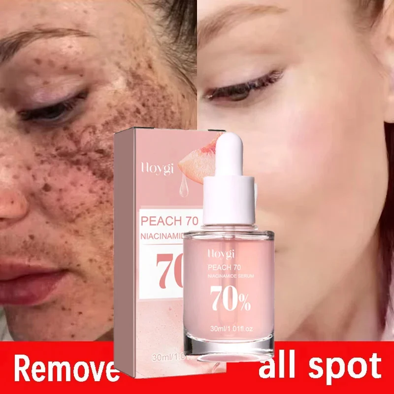 

Niacinamide Whitening Freckles Serum Removal Melasma Dark Spots Melanin correction Brightening Whiten Moisturize Beauty Care