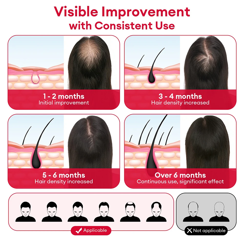 650nm+850nm Red Light Infrared - Hair Care Treatment ulasan dan harga