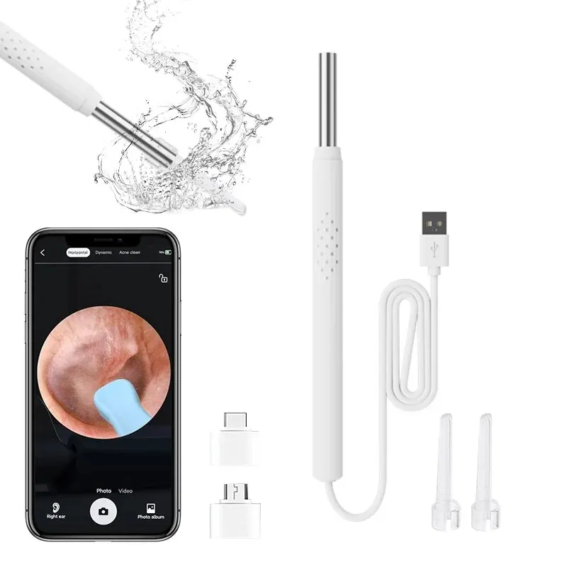 Smart Visual Ear Cleaner 3-in-1 Ear Sticks Otoscope USB C Charging Endoscope Wax Removal Tool Earpick Mini Camera Health Care