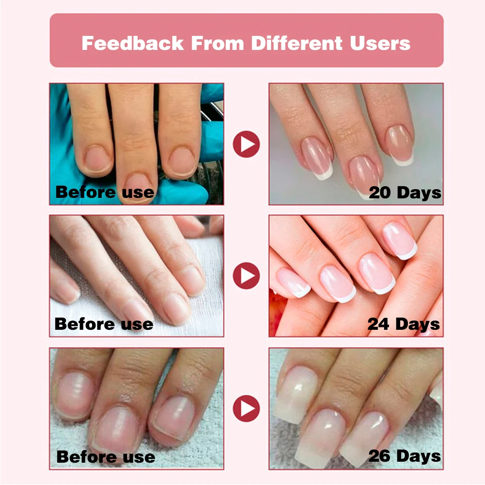 KODIES GEL Nail Strengthener Growth Restore Hardener Clear Nail Polish Base Coat Fast Dry 15ML Strong Repair Nail Art Treatment