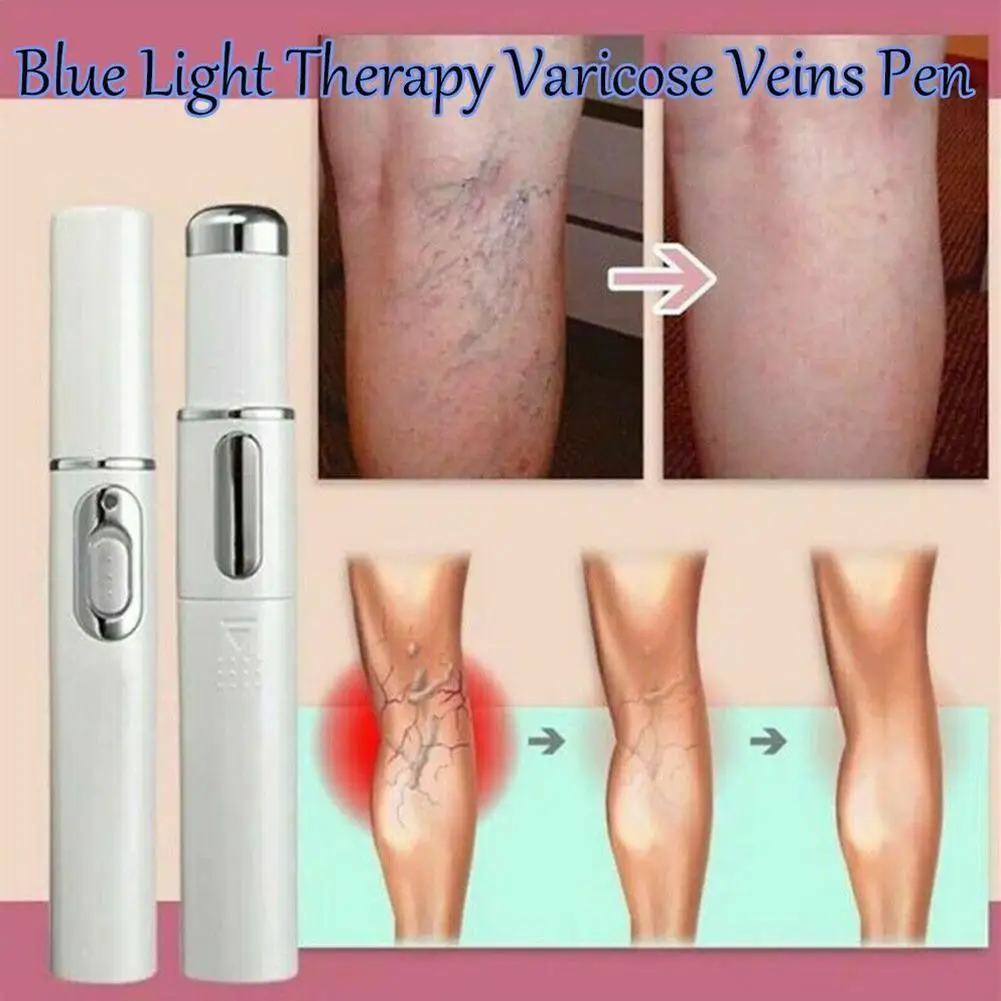 

Laser Treatment Phlebitis Vasculitis Anti Swelling Blood Vessel Bulge Pain Blood Circulation High-quality Varicose Vein Device