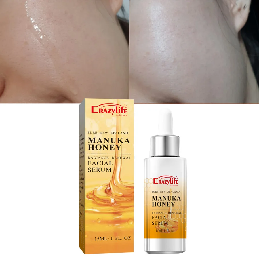 Manuka Honig Gold Gesichts serum Reparatur Essenz Feuchtigkeit söl Kontrolle Schrumpfen Poren Lifing Anti-Falten-Gesichts serum