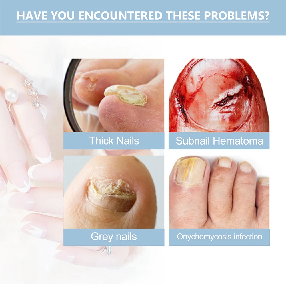 爪の修復液,栄養血清,ケアエッセンス,活性化,強化,15ml