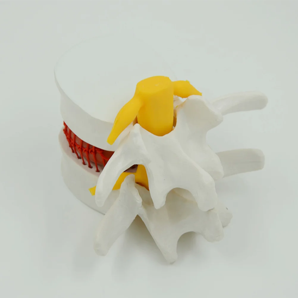 Lumbar Spine Model for Demonstrating Intervertebral Disc Models Anatomical Herniation Human Body