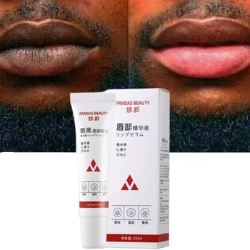 1 Stuk Lippen Roze Verse Bliksembleekcrème Behandeling Verwijderen Donkere Rook Lippen Lippenbalsem