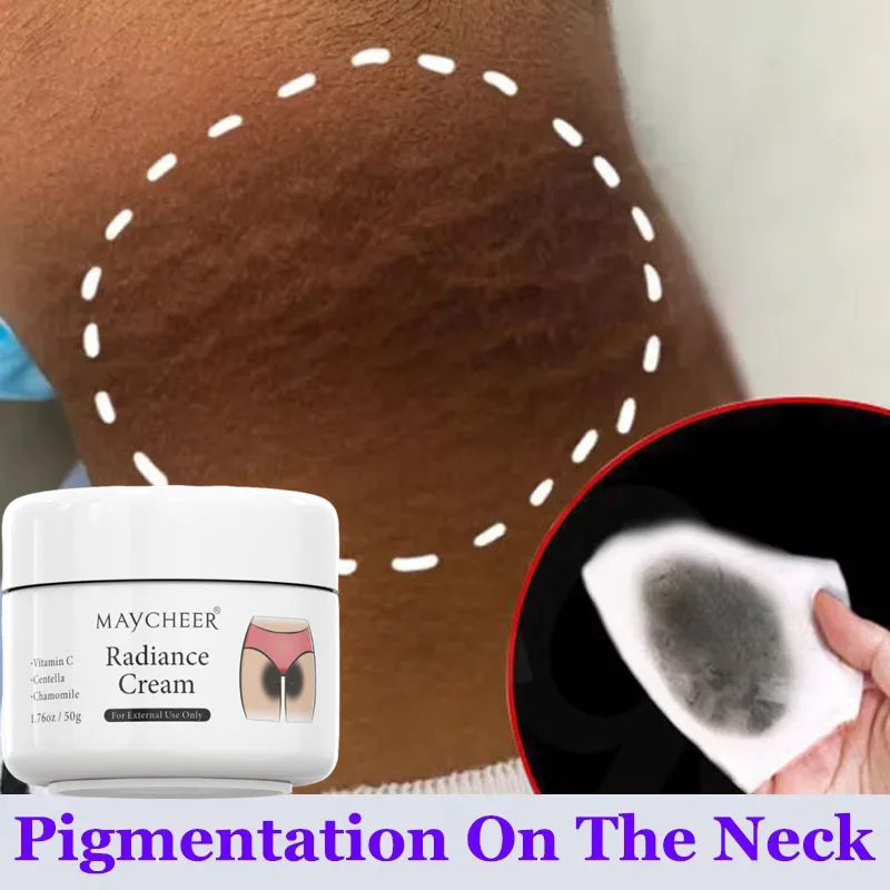 Crema Blanqueadora para Partes Íntimas, Suero Aclarante para Axilas, Blanquea Glúteos, Rodillas, Entrepierna, Elimina la Melanina