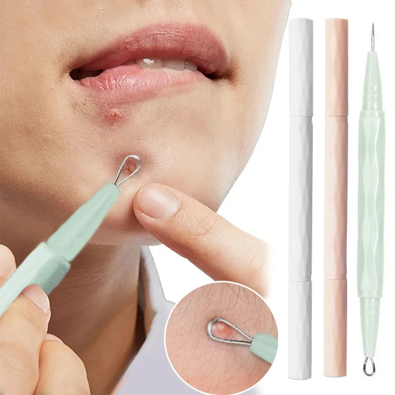 مزدوج الرؤوس السوداء حب الشباب بثرة الإبر العيب Comedone النازع مزيل الفولاذ المقاوم للصدأ التنظيف العميق المسام أدوات العناية بالبشرة