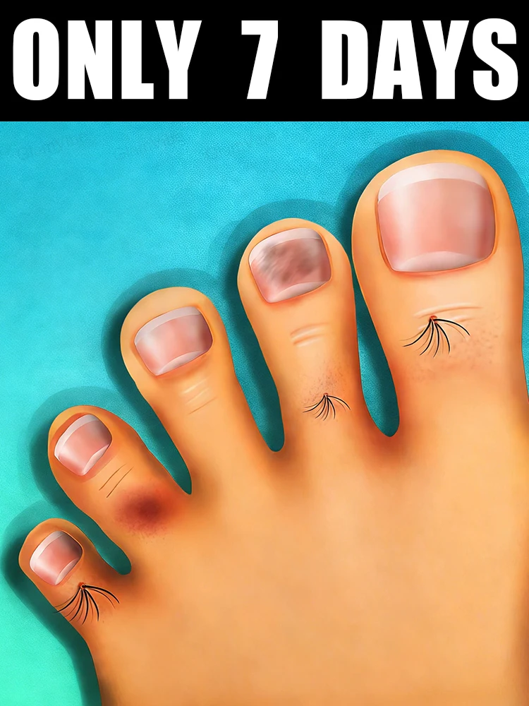 

Great news! Free shipping in 2026! Nail care solution, 10ml