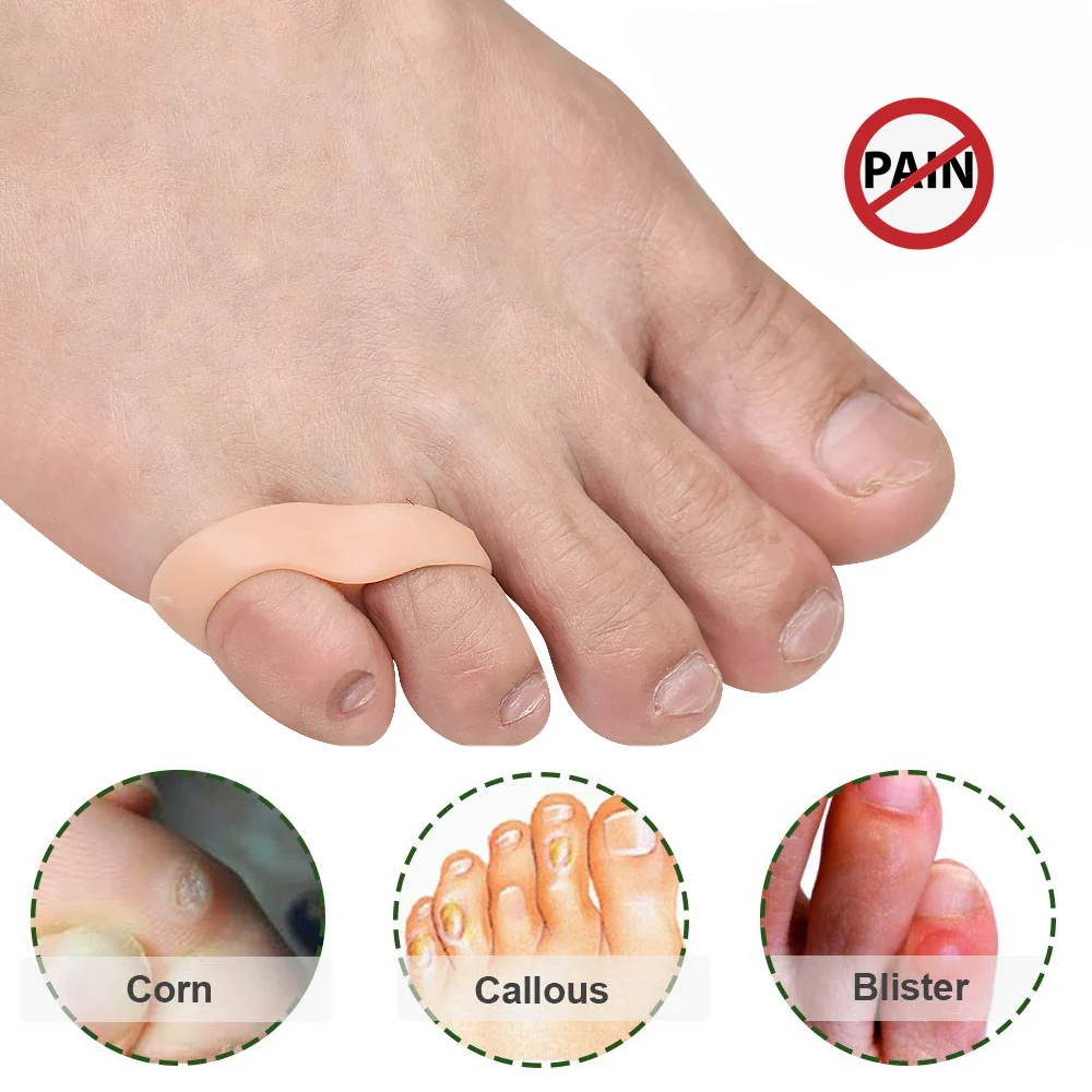 Pexmen 2 Teile/para Gel Kleine Toe Separator Wenig Kappe Protector Spacer Pinky Toe Corrector für Bunion Schmerzen Kallus und Blister