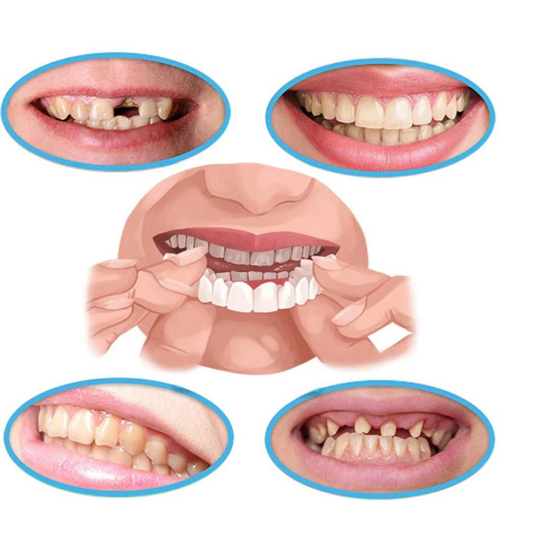 Food grade Teeth Veneers Tooth Cover Set Dentures Dental Veneers Snap On Cover The Teeth Fake Tooth Instant Confidence Smile