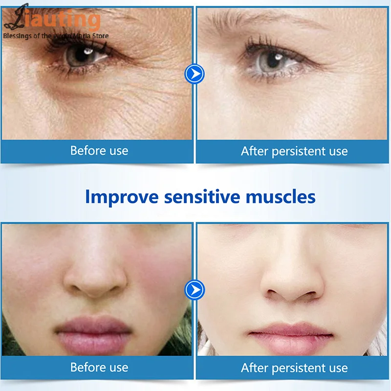 

Facial Hydrolyzed Silk Protein Collagen Thread Ball Serum Moisturizer Hydration Lifting Firm Fine Lines Essence Skin Care