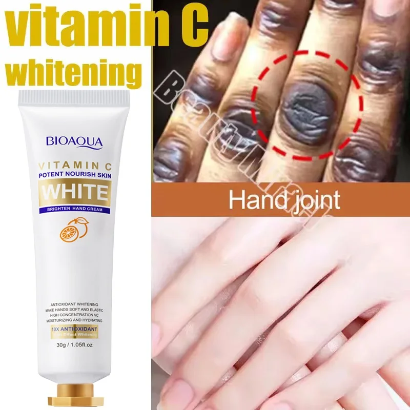 Fast Whitening Dark Knuckles Brighten Hand Cream Melanin Corrector Moisturizing Intense Stains Remover Products Skin Care