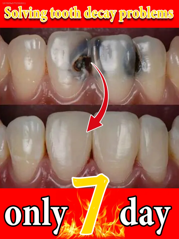 Everyday Oral Maintenance Toothpaste for Adults, Soft Cleansing Formula Wash Away Surface Tooth Stains, Optimize Teeth Visual Effect, Deliver Comfortable Fresh Breath
