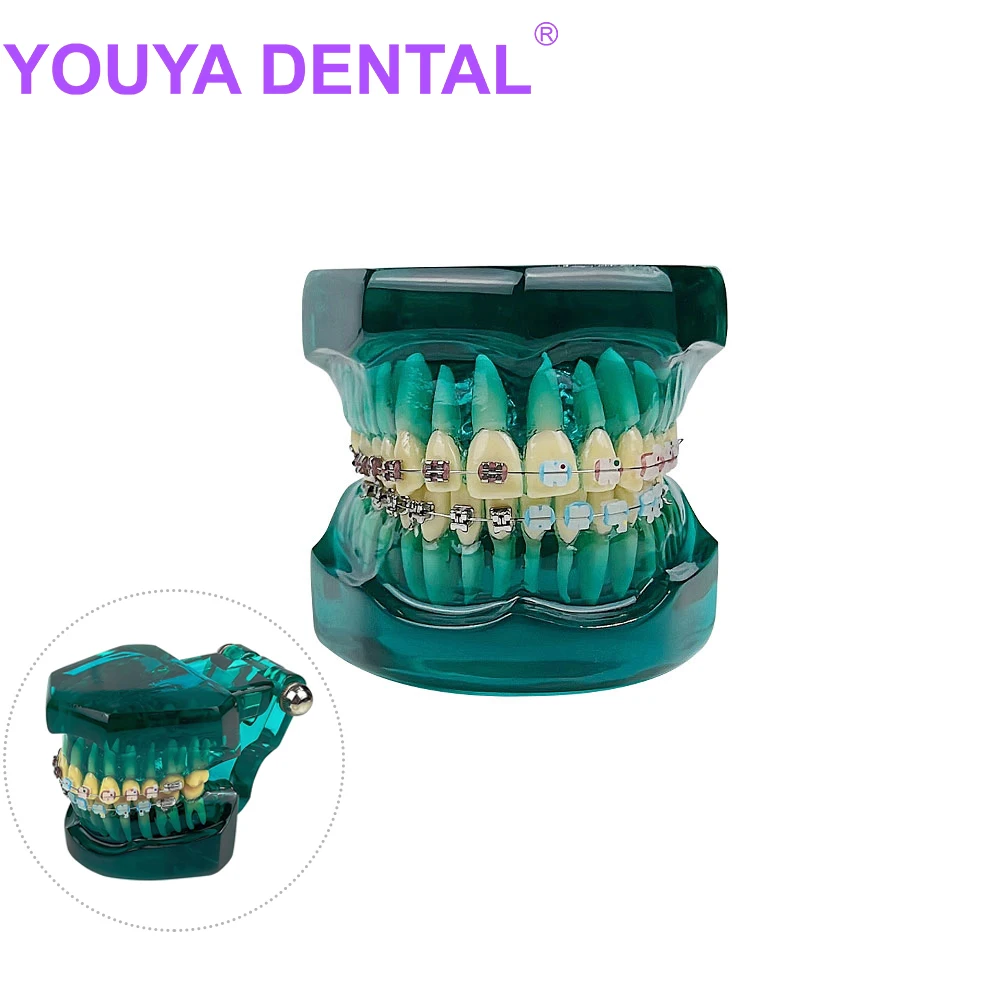 

Orthodontic Teeth Model With Metal Ceramic Braces Bracket For Medical Science Dental Disease Teaching Study Dental Implant Model